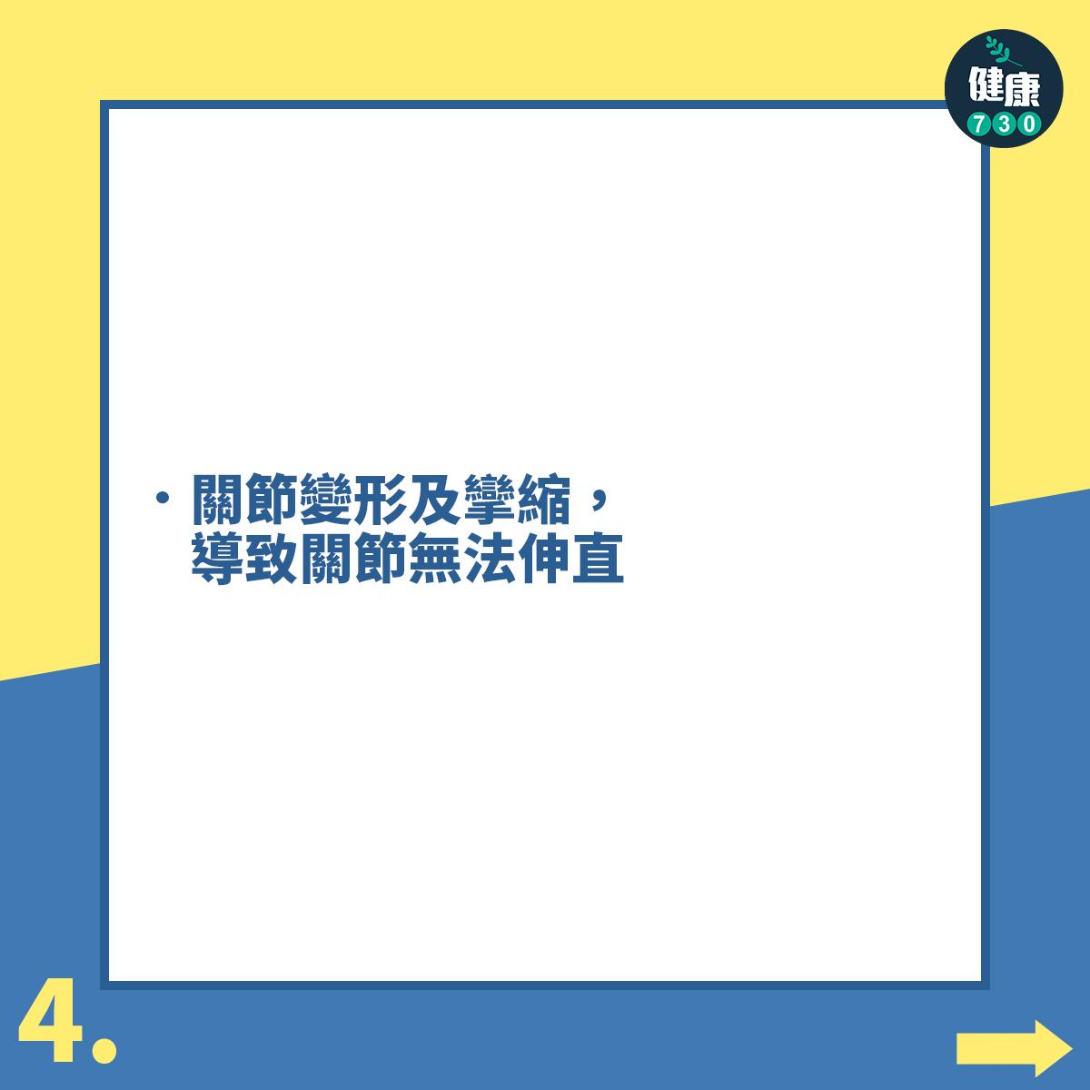 關節炎|退化性膝關節炎常見症狀(am730製圖)