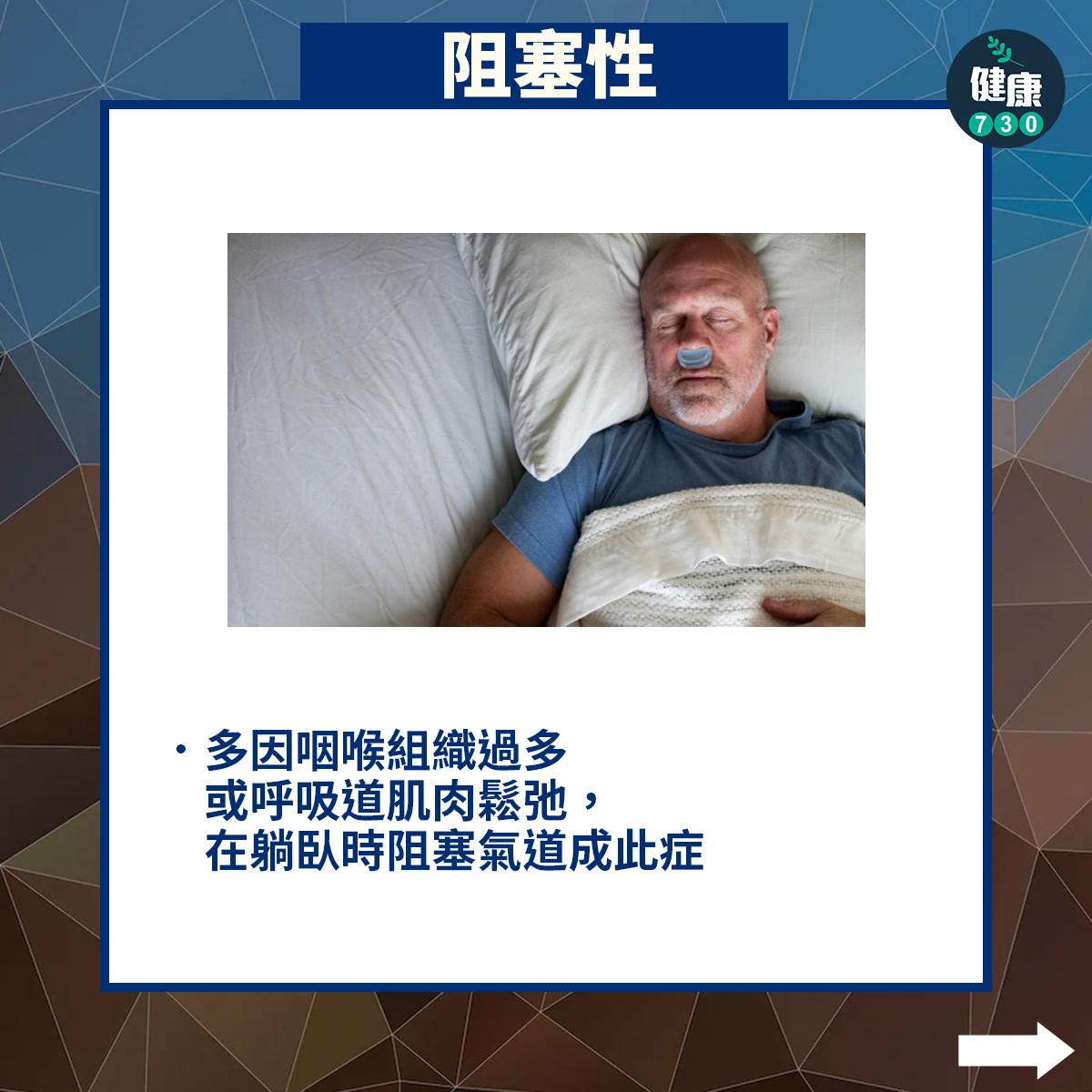 阻塞性多因咽喉組織過多或呼吸道肌肉鬆弛,在躺臥時阻塞氣道成此症