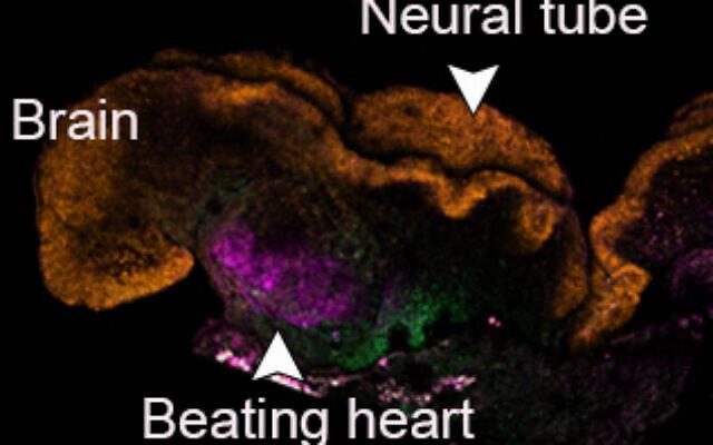 小鼠胚胎有神經管、腦部及心跳。(互聯網)
