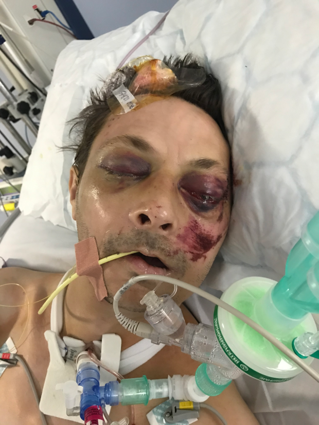 威爾遜當日被打至「不似人形」。(互聯網)