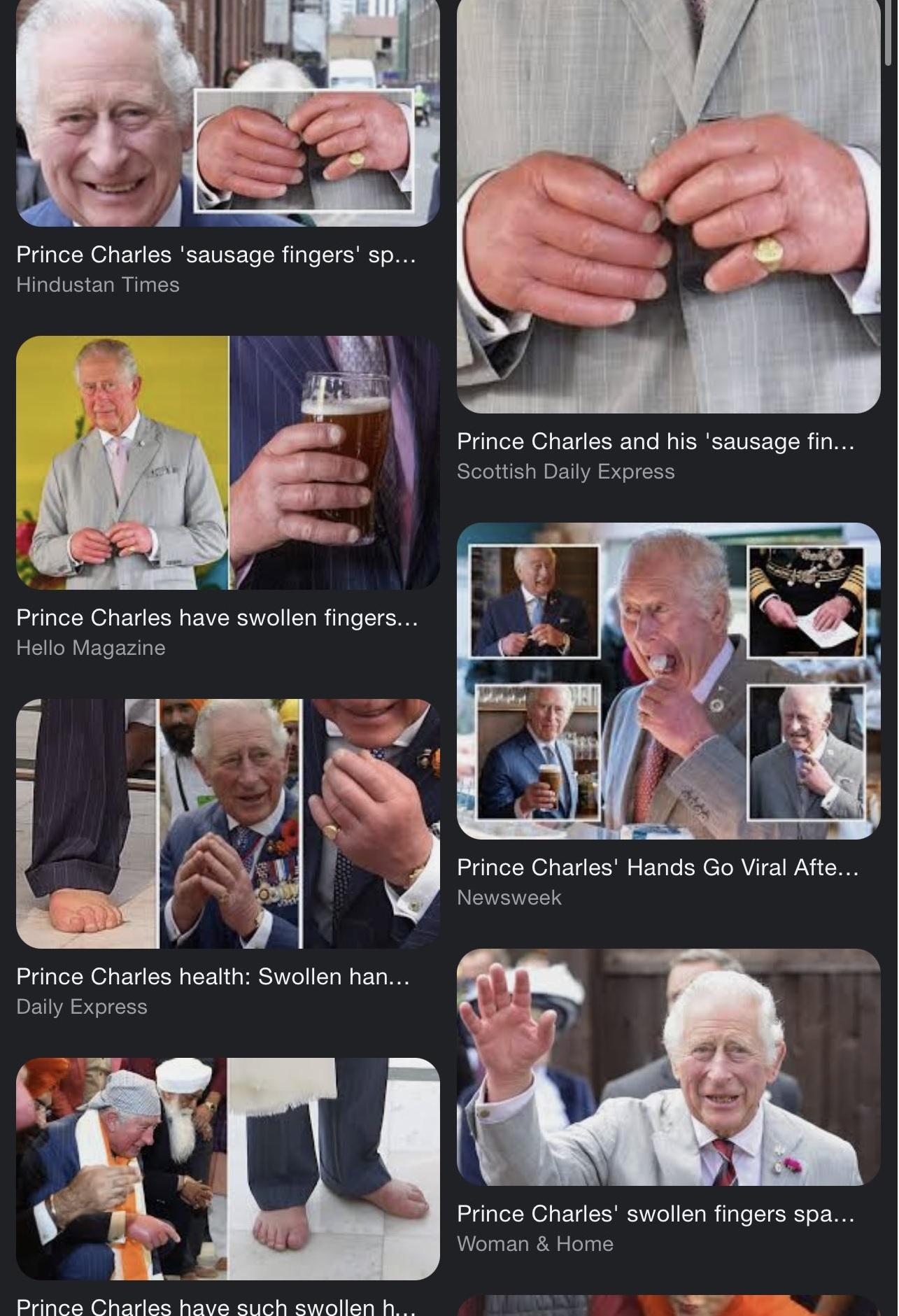 網民貼出查理斯三世一系列「香腸手指」照片。(互聯網)