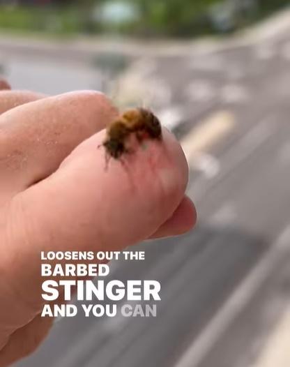 Elisha Bixler指這隻蜜蜂螫人後突然後悔不想死,因此要不停轉圈以拔出螫針。(IG)