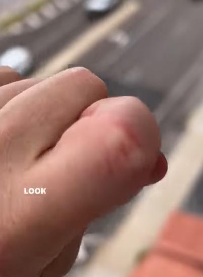 至於她的手指竟然並無受傷,Elisha Bixler則說,其實已試過幾次,只是來不及及拍下。(IG)