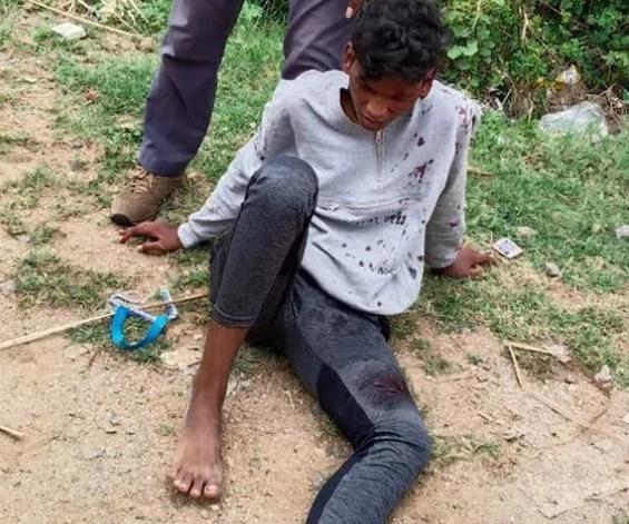 Ch Akshay Raj腿部當場骨折、面部受傷,血流披面。(Twitter)