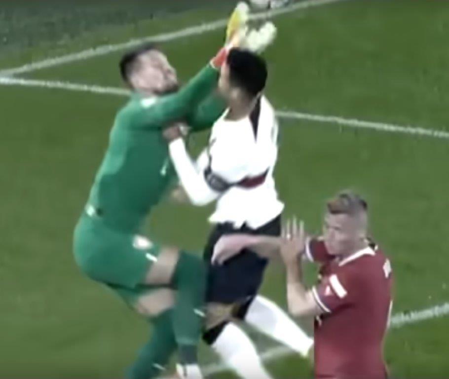 C朗與出迎門將相撞爆鼻