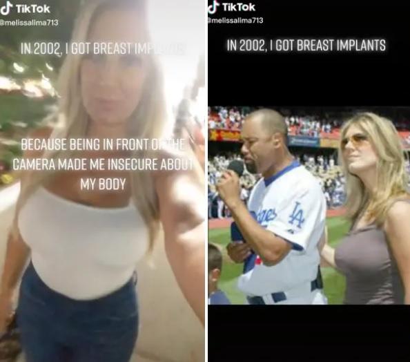 梅利莎在社交平台分享其隆胸的慘痛經歷。(互聯網)