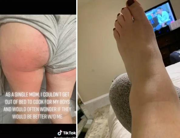 梅利莎說她病到無法下床。(互聯網)