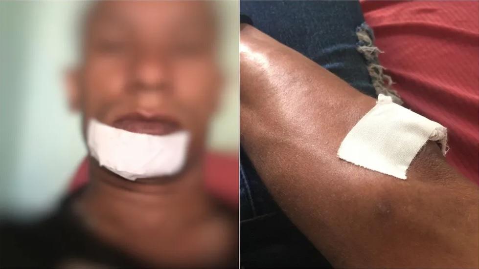 男遊客下巴和手臂受傷。(互聯網)