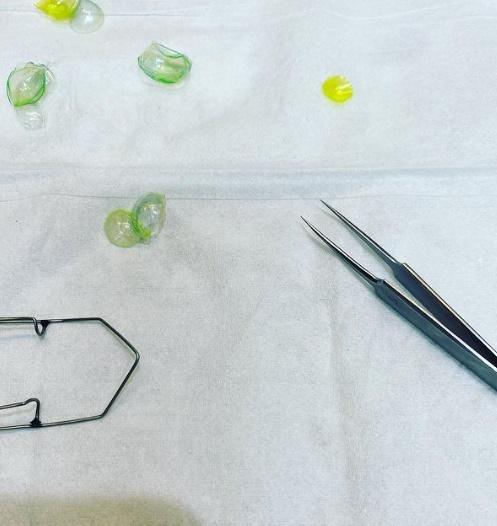 Katerina Kurteeva用棉花棒將隱形眼鏡推出,再用精密的儀械和鑷子將隱形眼鏡分開。(IG)