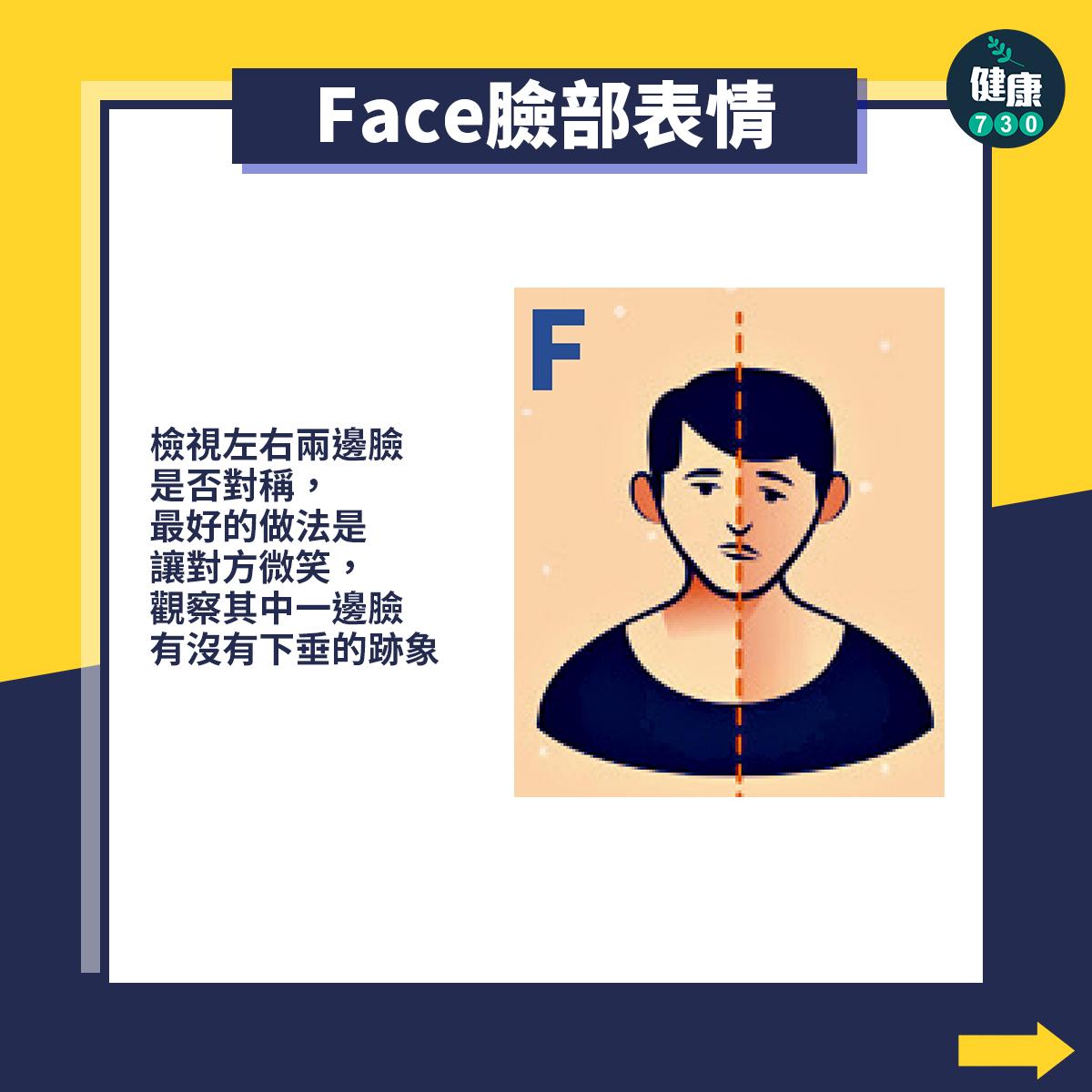 中風前兆︰Face臉部表情(am730製圖)