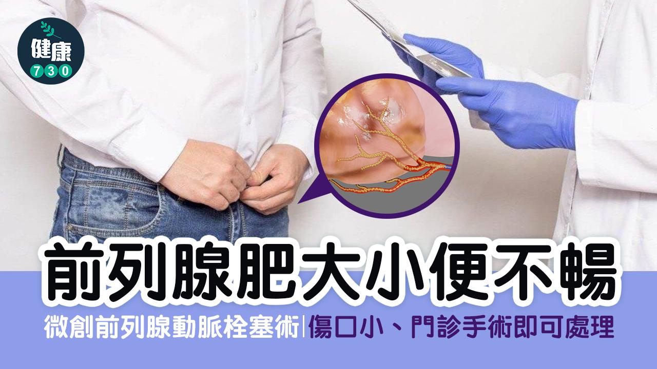 前列腺動脈栓塞治療能有效改善排尿不順的症狀,包括國際前列腺症狀量表分數以及生活品質量表分數的改善、尿流速顯著增加、前列腺體積縮小,及前列腺特異抗原降低。