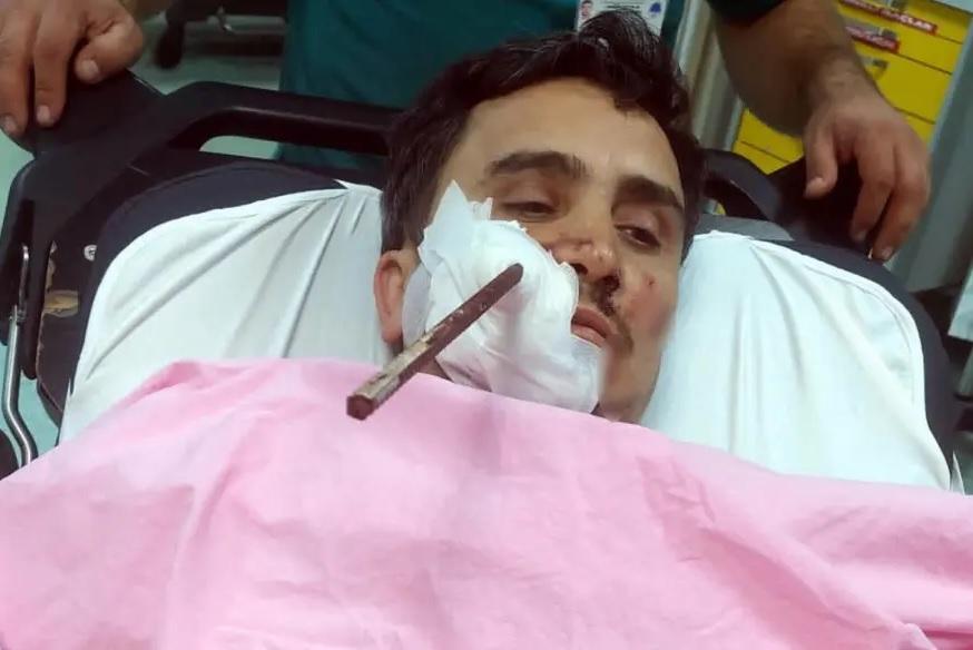 薩亞爾在醫院耐心等候治療。(互聯網)