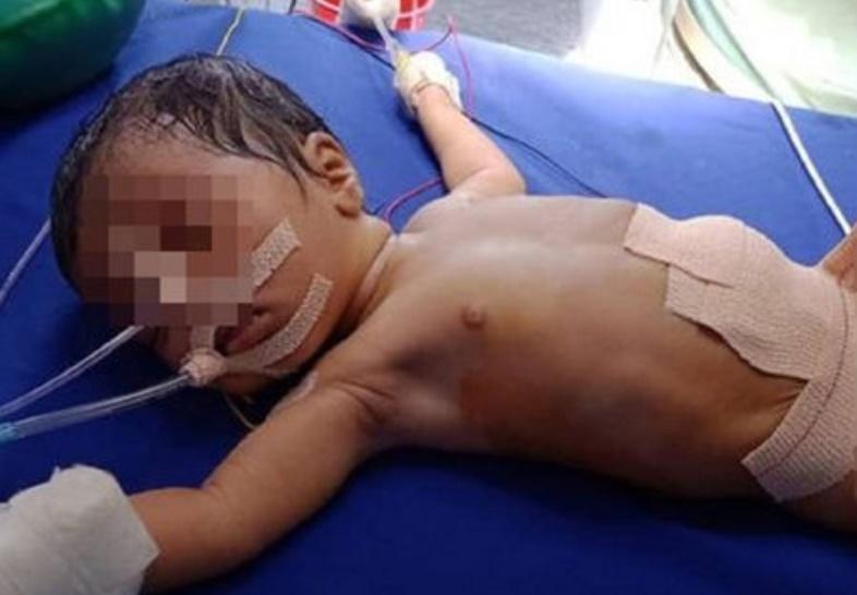 女嬰手術後恢復進度亦相當良好。(網上圖片)