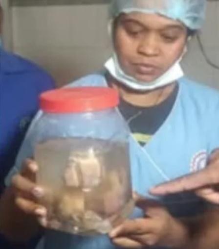 院方並未透露那些胚胎的發育狀況。(網上圖片)