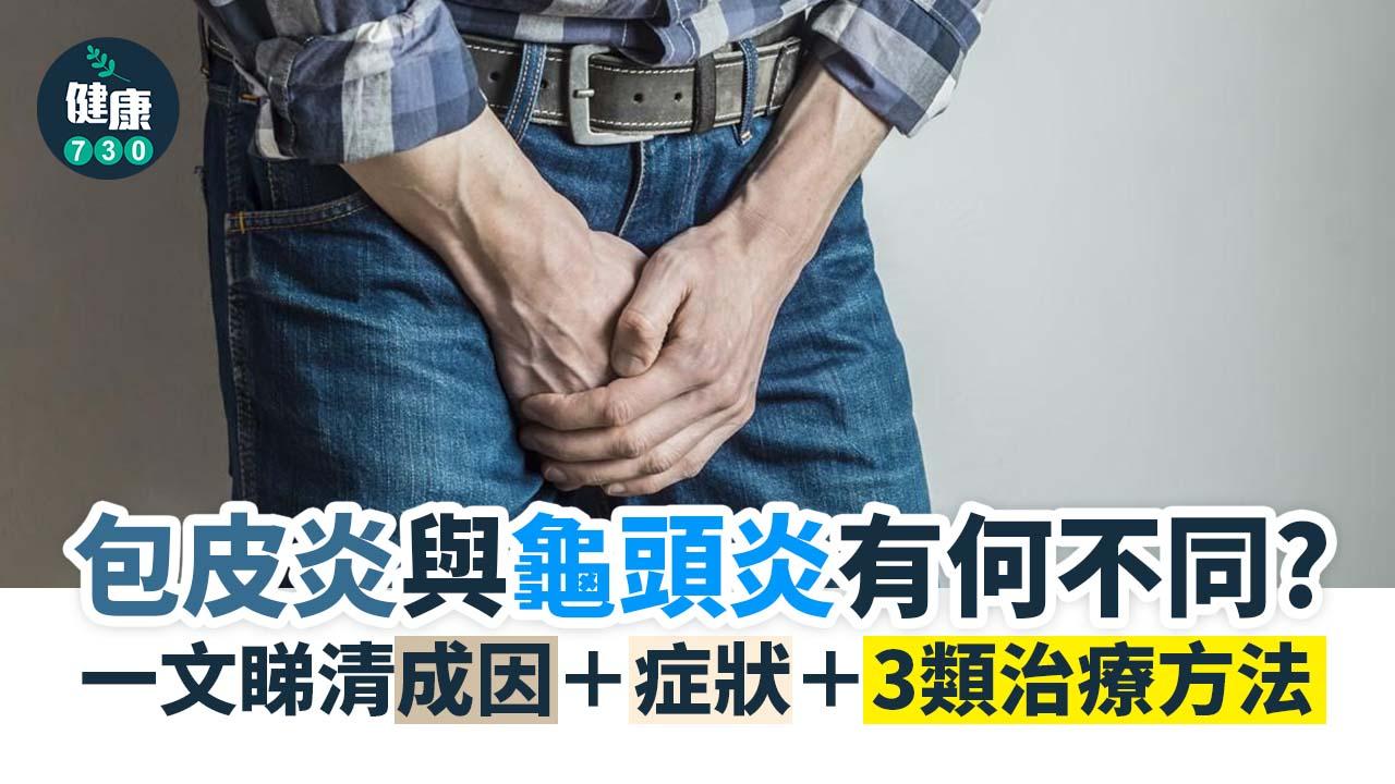 包皮炎(Posthitis)是男人最痛的其中一種炎症。