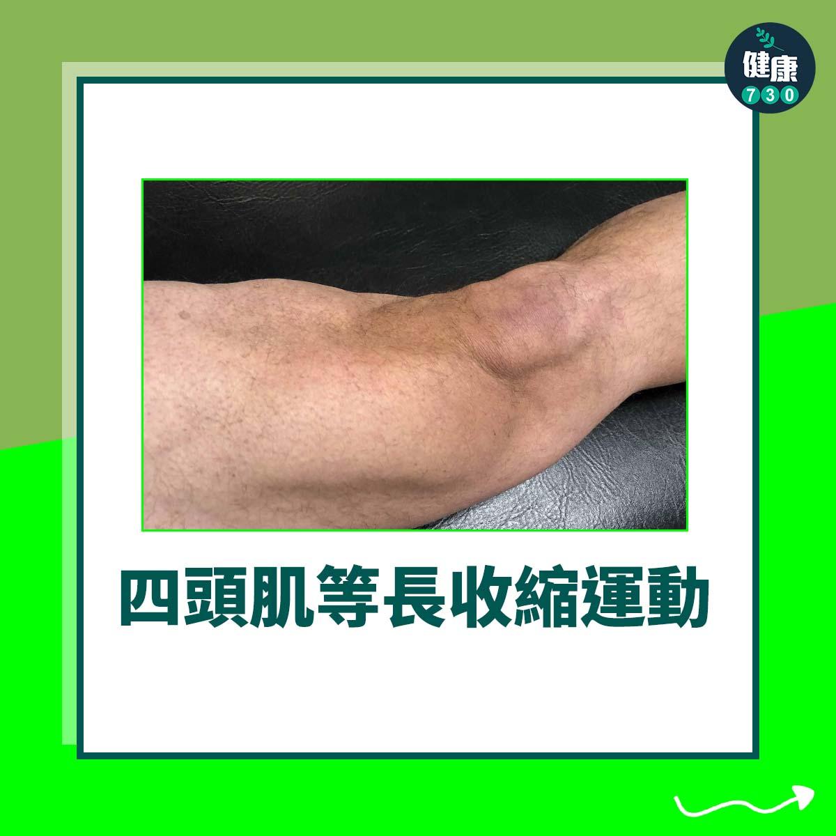 四頭肌等長收縮運動