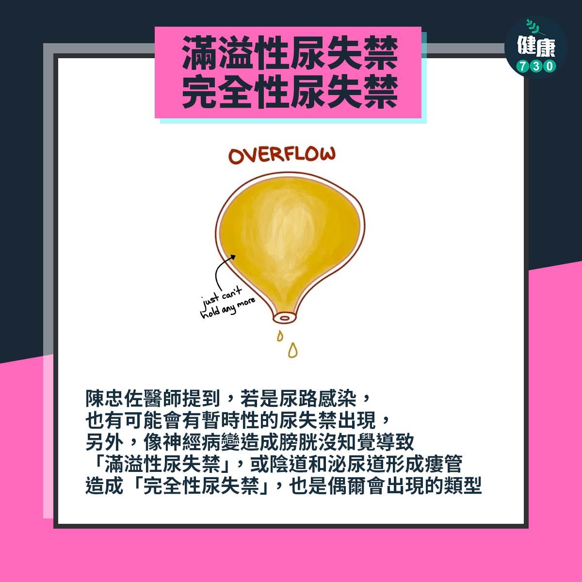 失禁原因|完全性尿失禁(am730製圖)
