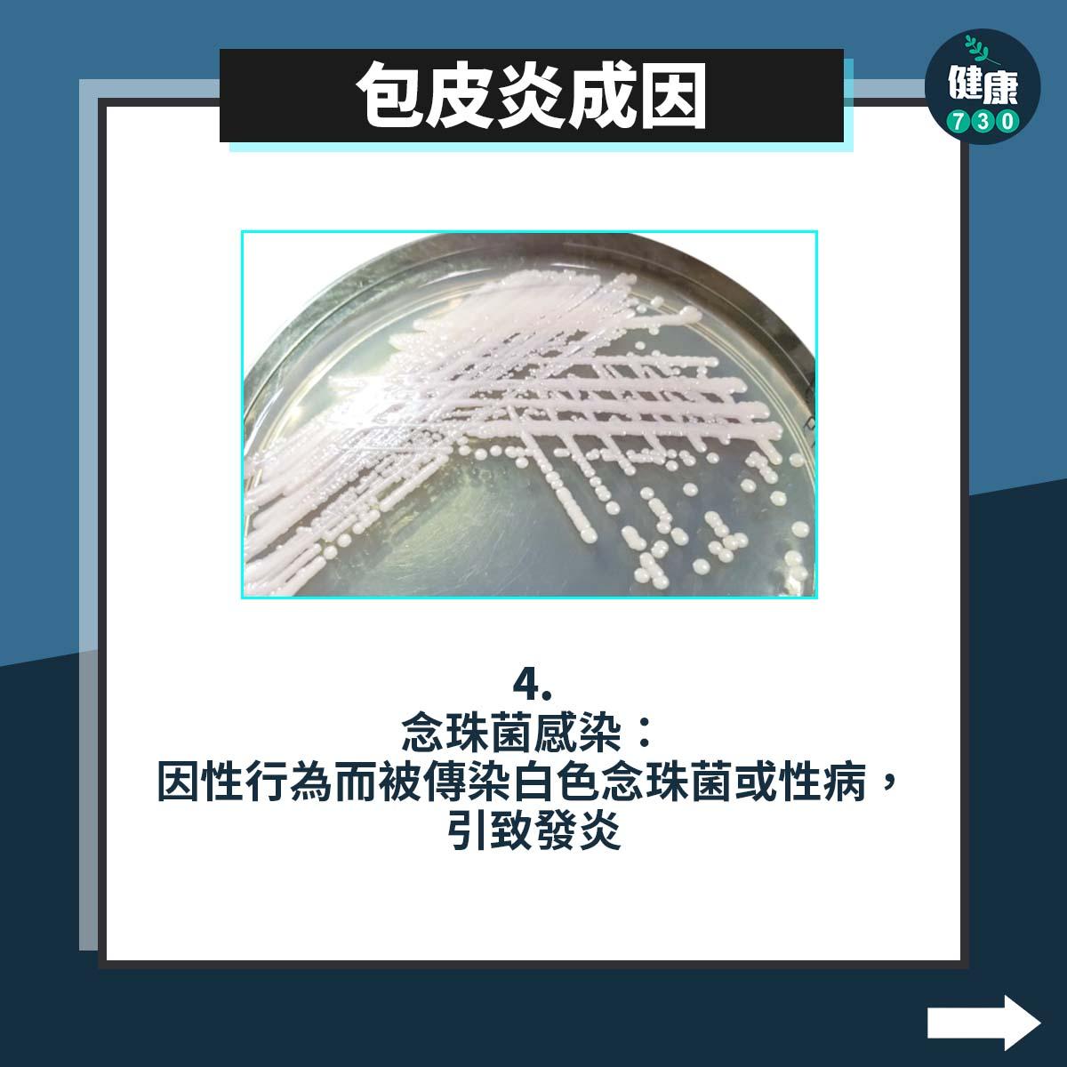 男性疾病|包皮炎成因包括包皮過長等原因(am730製圖)