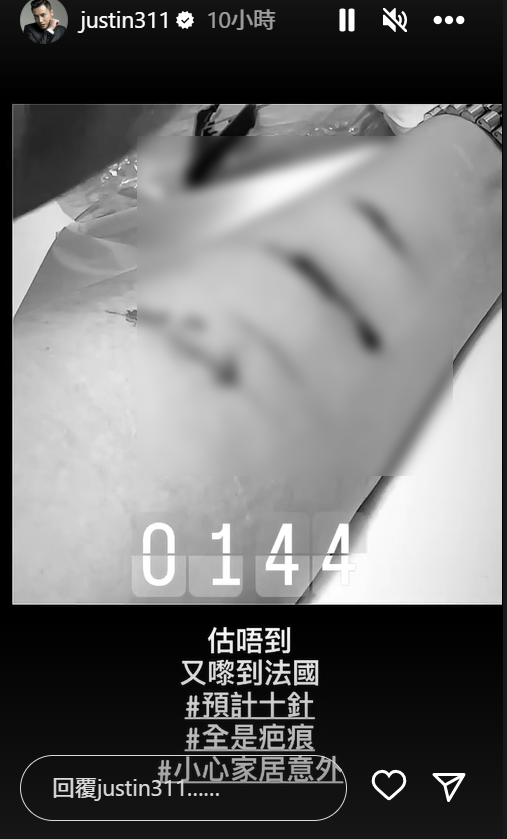 張建聲已把片段黑白處理,但仍然見到傷口非常深。(本報再以打格處理)