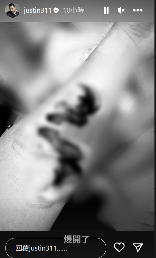 張建聲已把片段黑白,但仍然見到傷口非常深。(經打格處理)