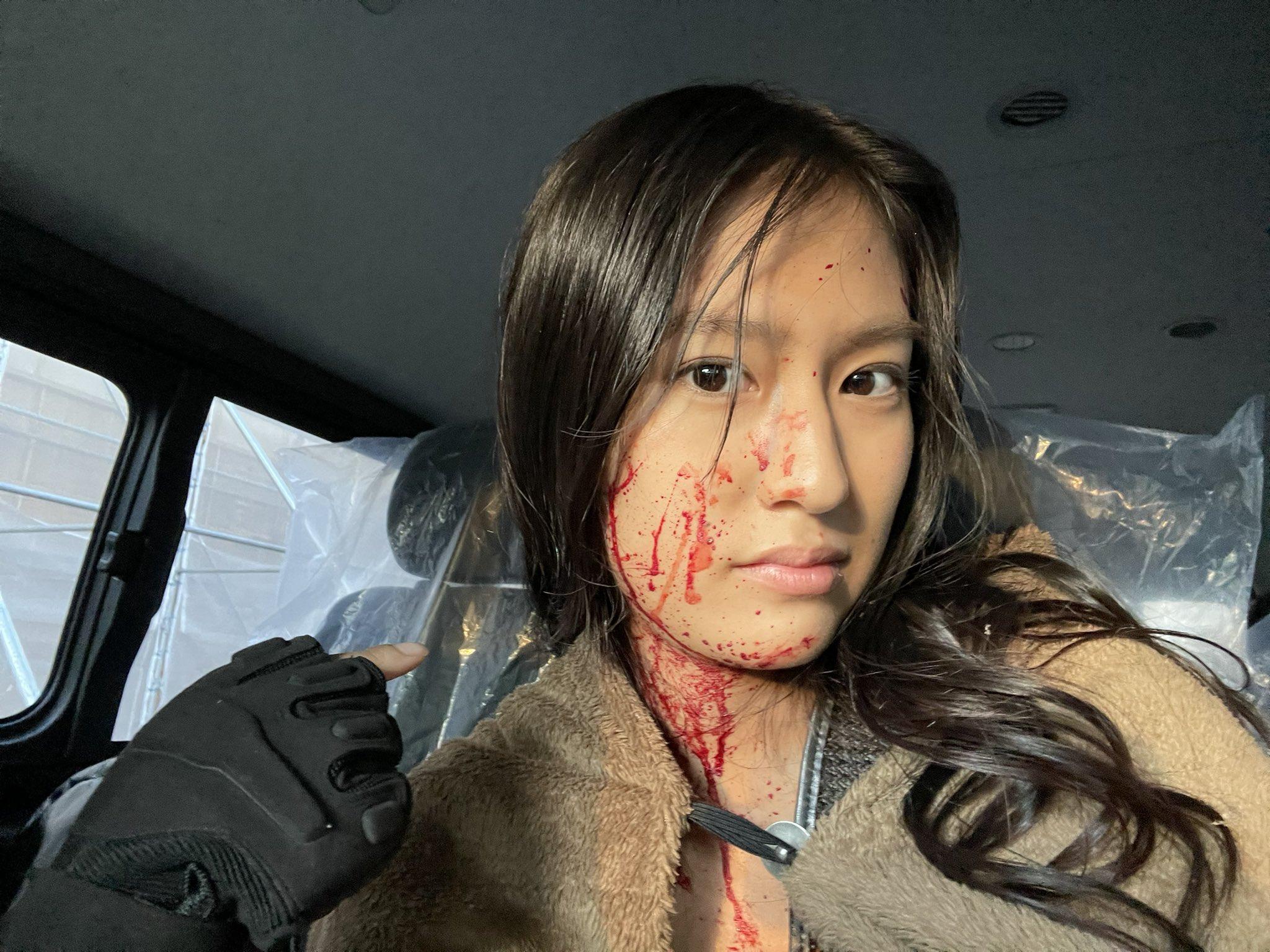 恒松祐里在《今際之國》中扮演失去左腳的女高中生。