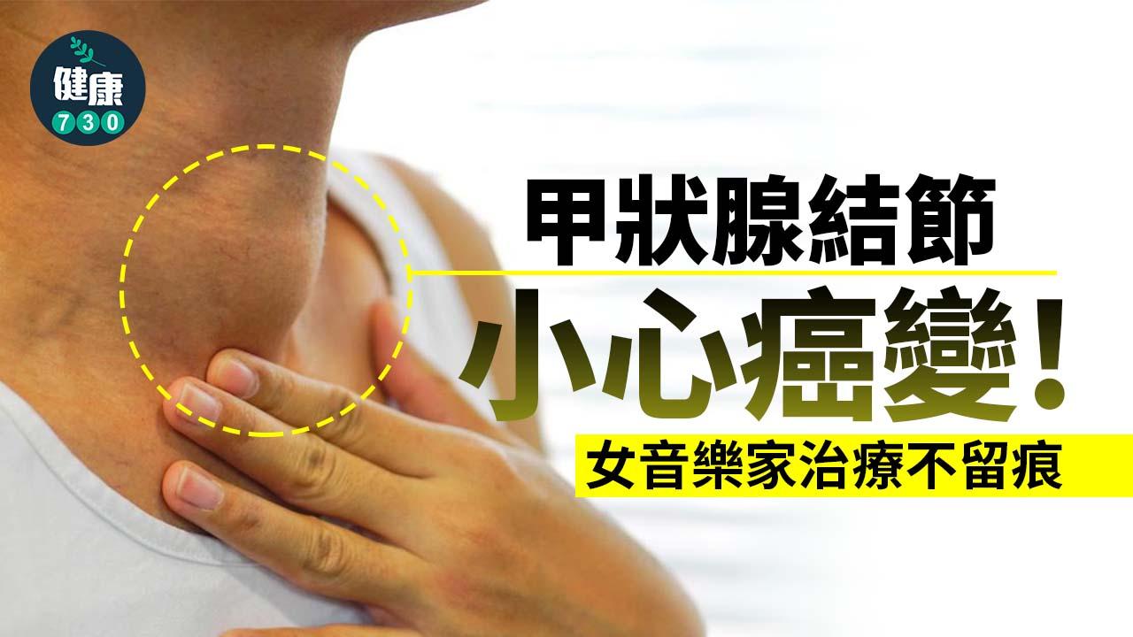 甲狀腺結節小心癌變!女音樂家治療不留痕