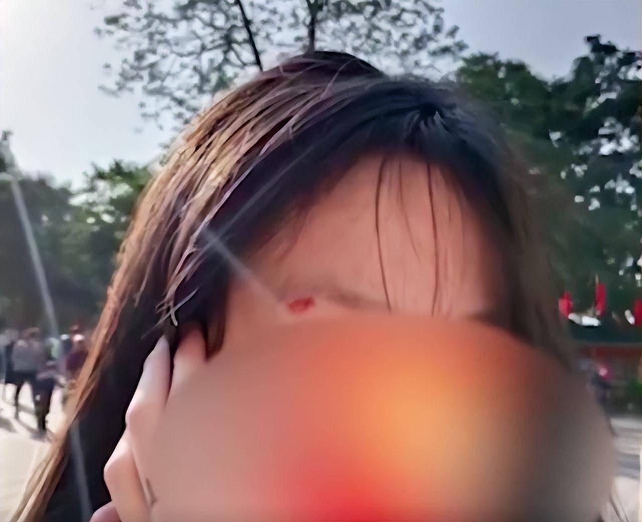 女子眉骨受傷流血。(互聯網)