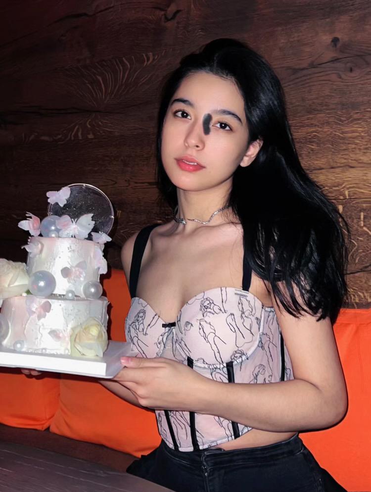 米熱從事模特兒工作,認為胎記能令自己「一眼就被人記住」。(小紅書)