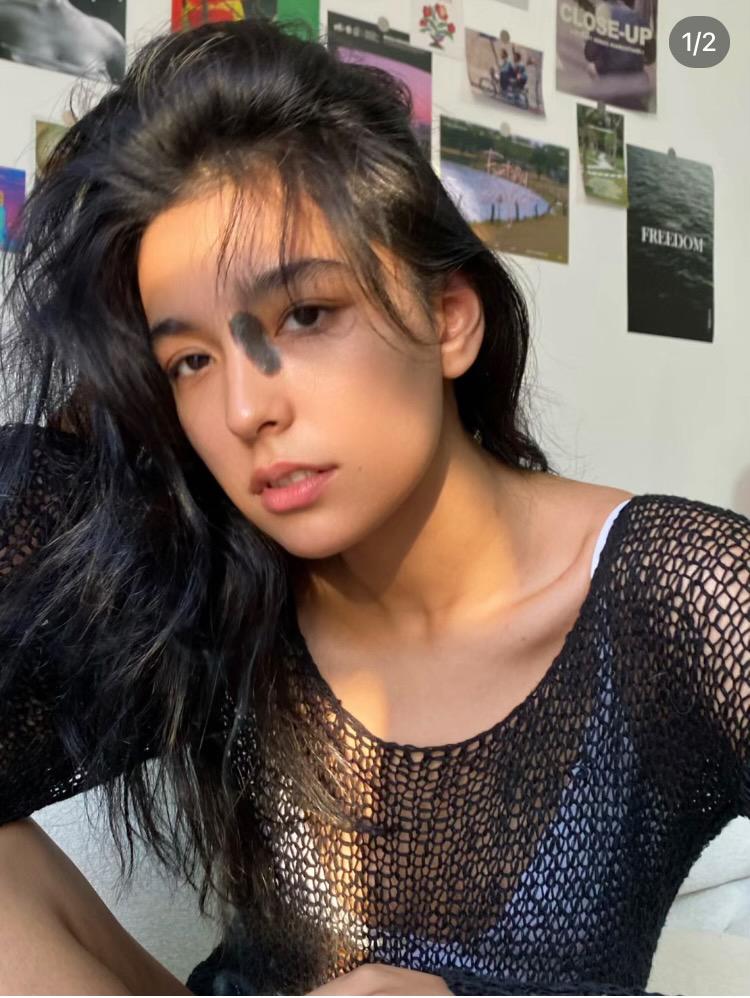 米熱從事模特兒工作,認為胎記能令自己「一眼就被人記住」。(小紅書)