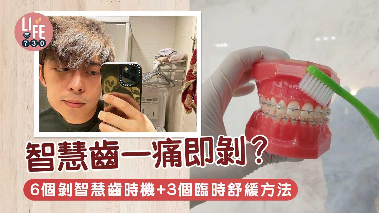智慧齒|智慧齒一痛即剝?!6個剝智慧齒時機+3個臨時舒緩方法