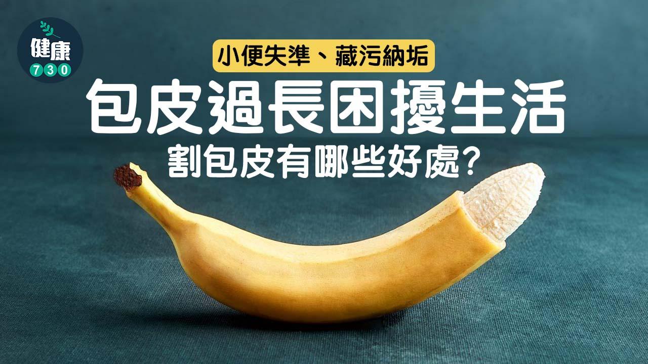 反覆發炎、藏污納垢需考慮割包皮。