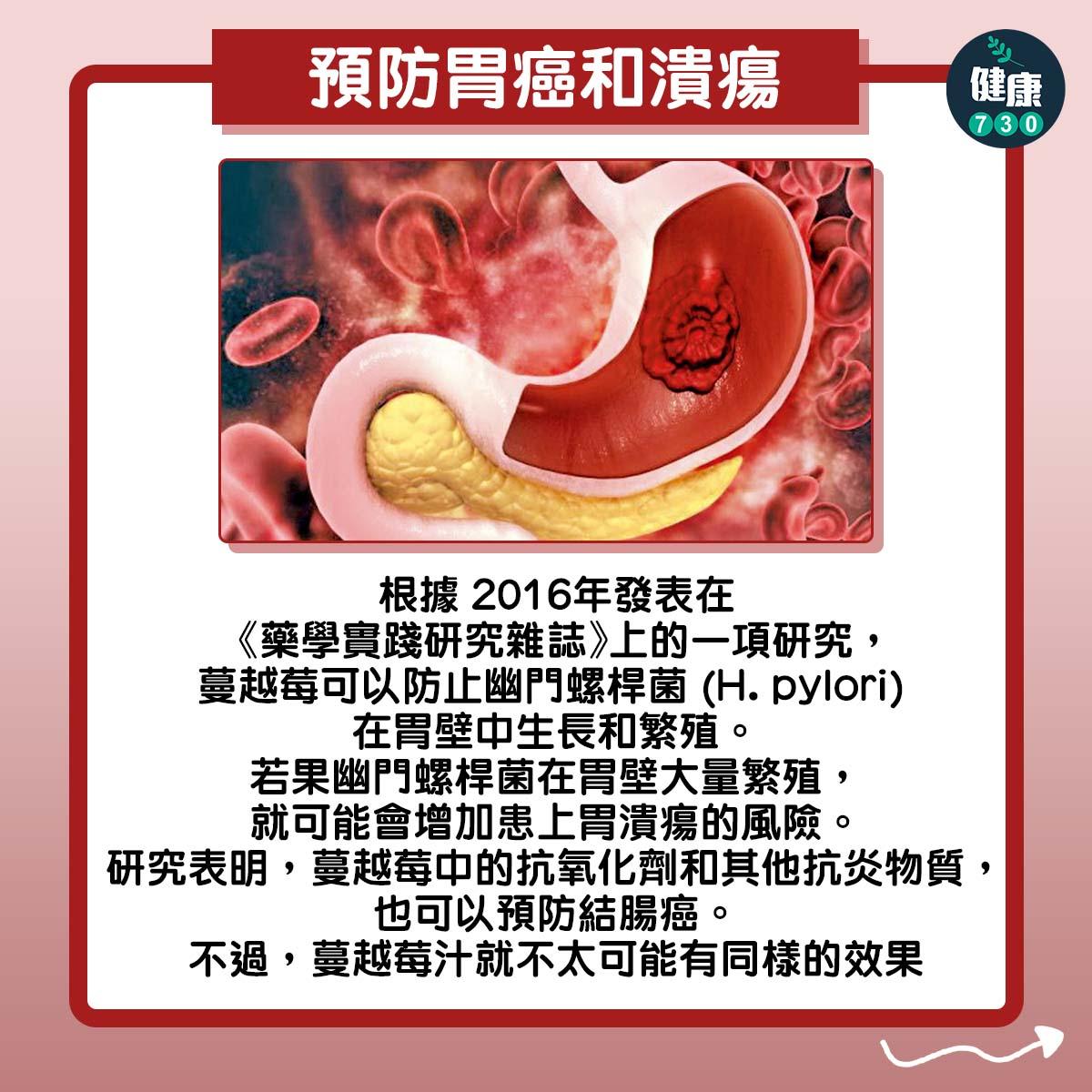 蔓越莓功效,預防胃癌和潰瘍