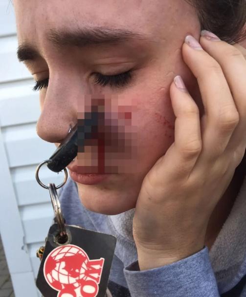 她走進廁所查看自己的傷勢,才在鏡中的畫面嚇了一跳。(YouTube)