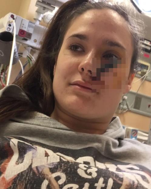 傷勢及意外原因實在太離奇,就連其他科的醫生都趕來一睹這「奇景」,更有醫生要求拍照。(YouTube)