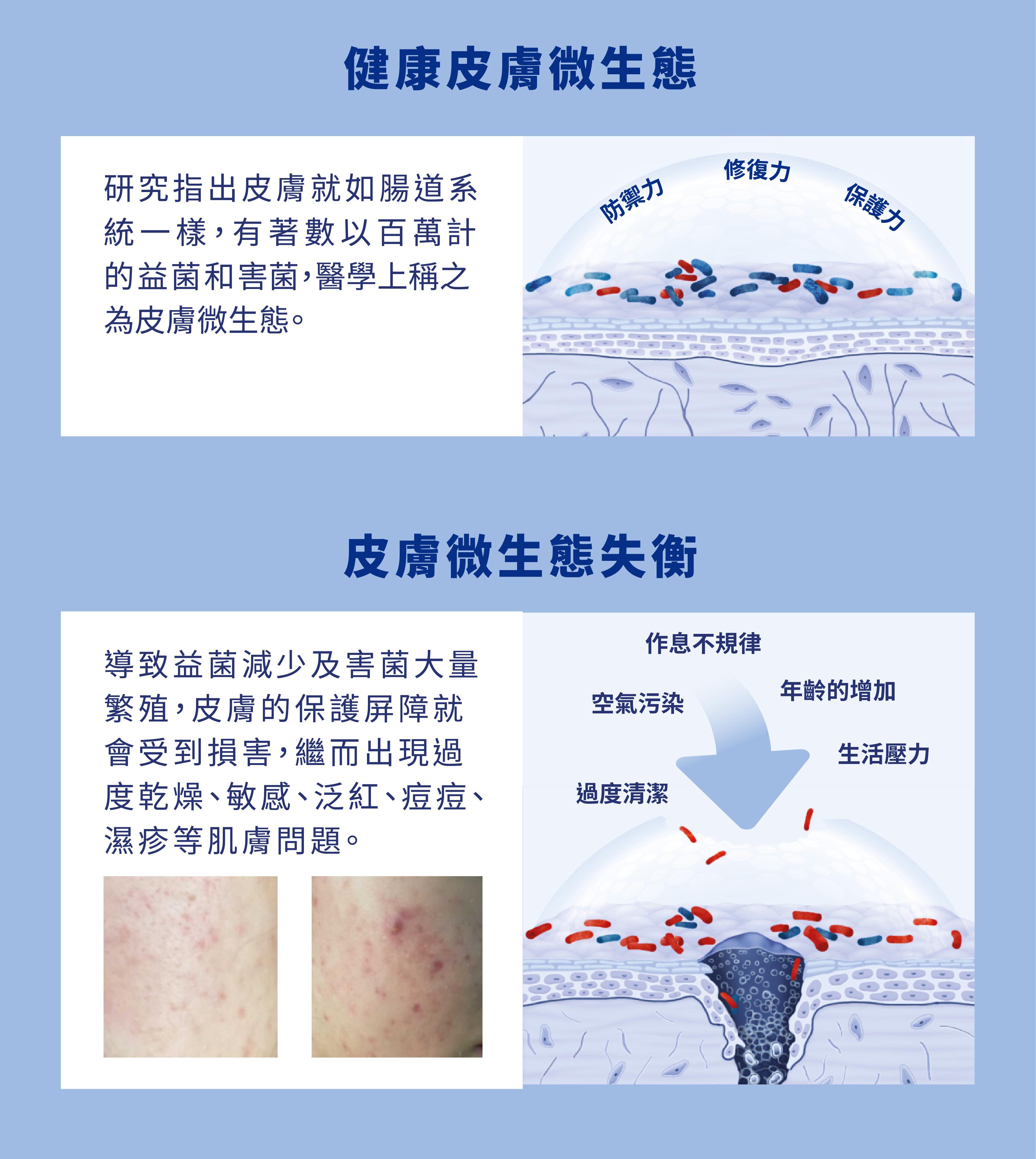 醫學研究指出皮膚pH值與肌膚微生態有密不可分的關係