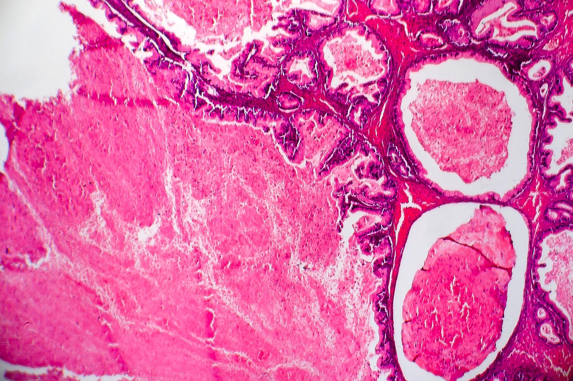 黃思齊教授將於「微流控晶片」中分享香港科學家如何使用微流控晶片研究癌症。
