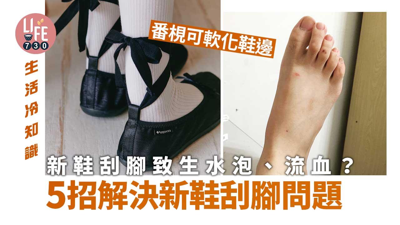新鞋刮腳生水泡、流血 5招解決新鞋刮腳 番梘可軟化鞋邊