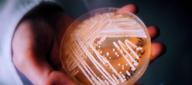 美國密歇根州一間紙廠爆發芽生真菌感染疫情。(互聯網)