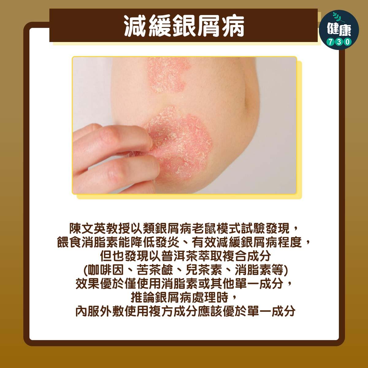 普洱茶功效|減緩銀屑病:陳文英教授以類銀屑病老鼠模式試驗發現,餵食消脂素能降低發炎、有效減緩銀屑病程度,但也發現以普洱茶萃取複合成分(咖啡因、苦茶鹼、兒茶素、消脂素等)效果優於僅使用消脂素或其他單一成分,推論銀屑病處理時,內服外敷使用複方成分應該優於單一成分。