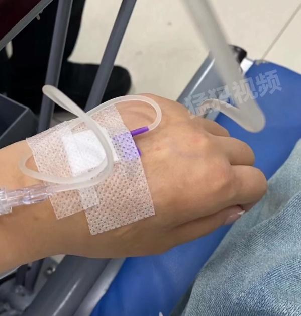 女事主被蜈蚣咬後,立即用肥皂清洗傷口,隨後前往醫院急診救治。(微博)