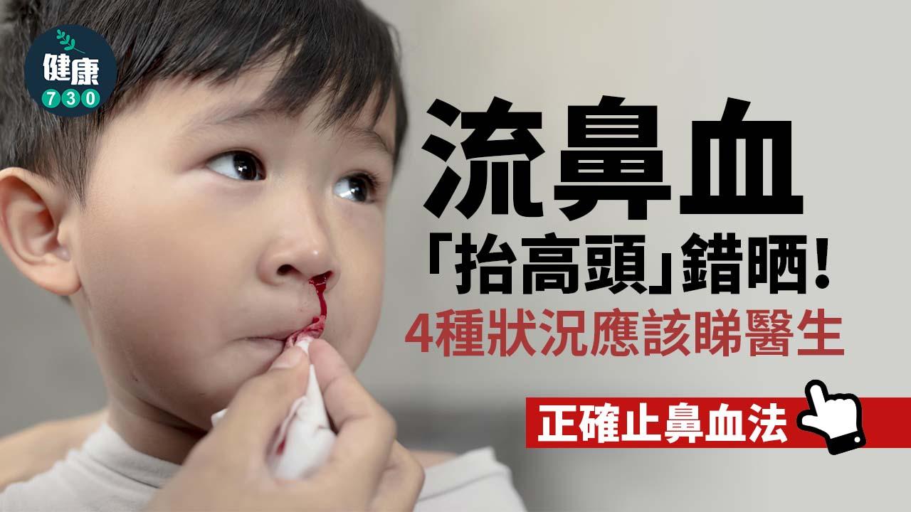 不少家長都教孩子流鼻血時「頭往後仰」,不過醫師提醒,血水往喉嚨灌容易嗆到甚至暈倒!