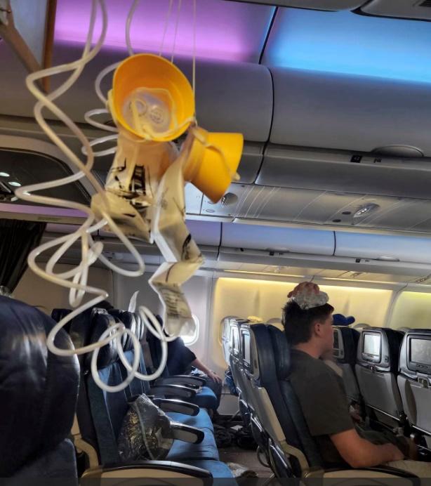 網上圖片顯示,機艙天花板穿了個洞,有氧氣罩跌頭,有一名男乘客正以冰敷頭。(Twitter)