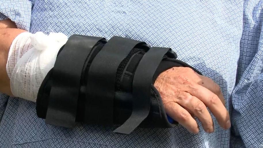 Lynn Kelly慶幸自己只受了輕傷,形容是相當幸運。(Twitter)