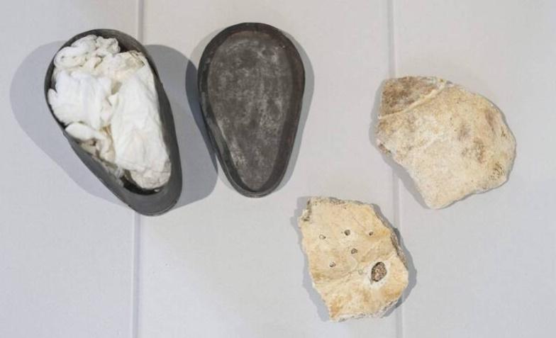 遺骸碎片一共有10塊,其中較大的2塊分別為頭骨後部及前額右部分。(網上圖片)