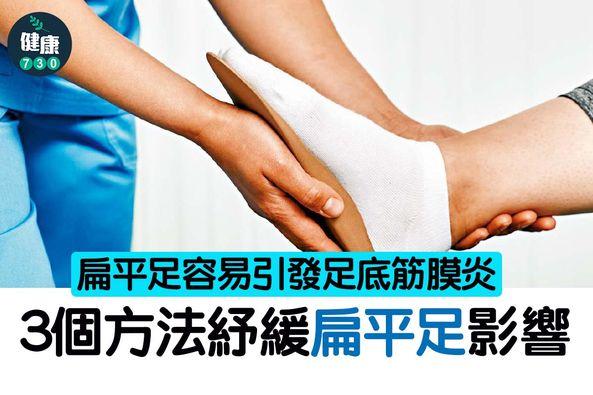 3個方法紓緩扁平足。(am730製圖)