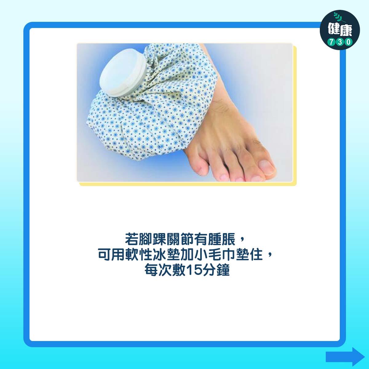 3個方法紓緩扁平足。(am730製圖)