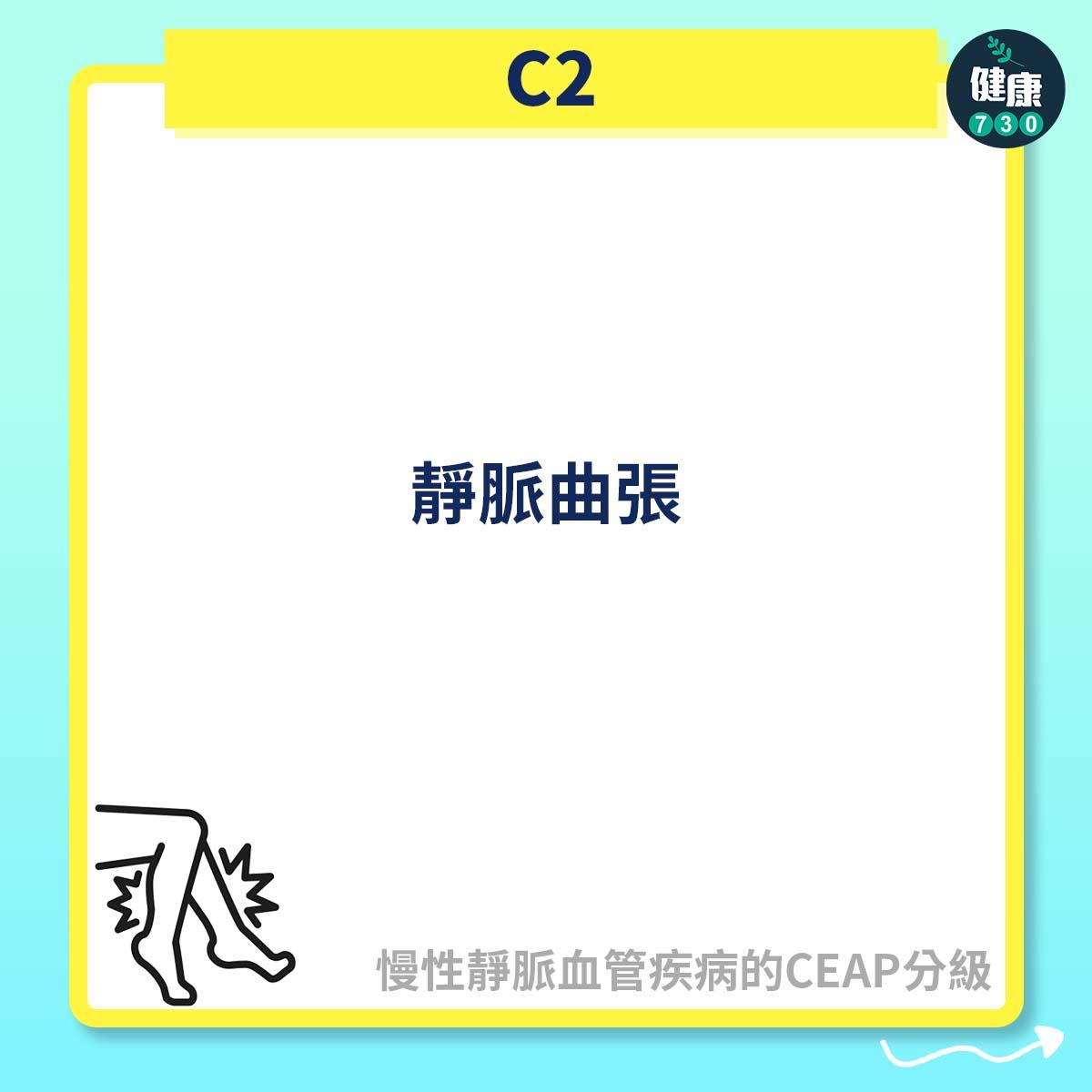 C2:靜脈曲張