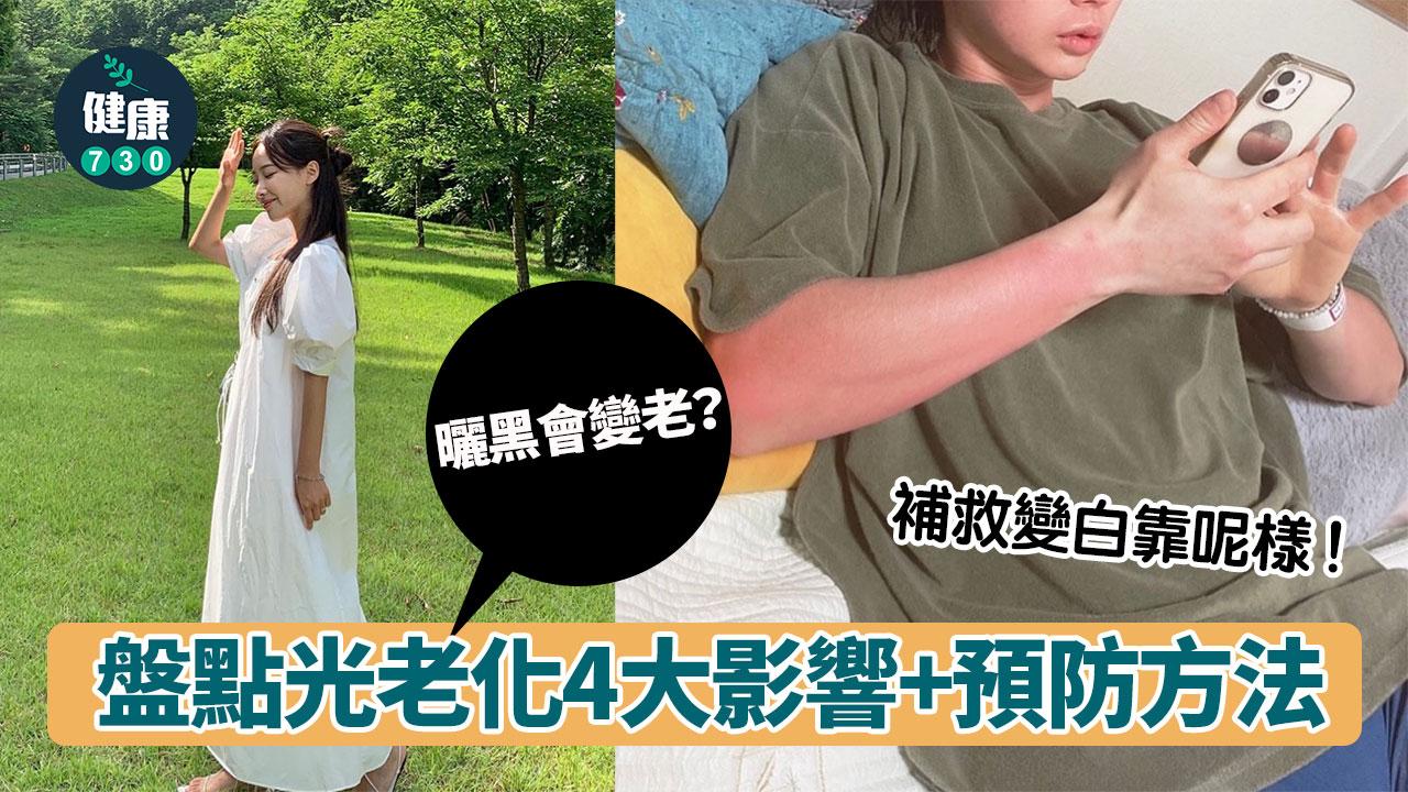 夏天防曬|曬黑會變老? 盤點光老化4大影響+預防方法 補救變白靠呢樣!