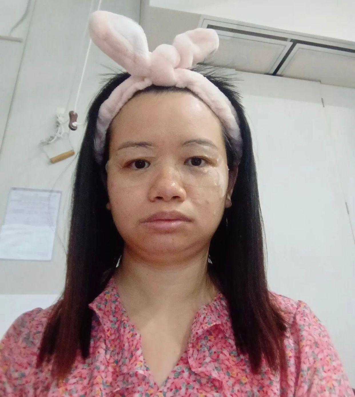 阿儀近期更添自信,今日公開敷眼膜的素顏大特寫。