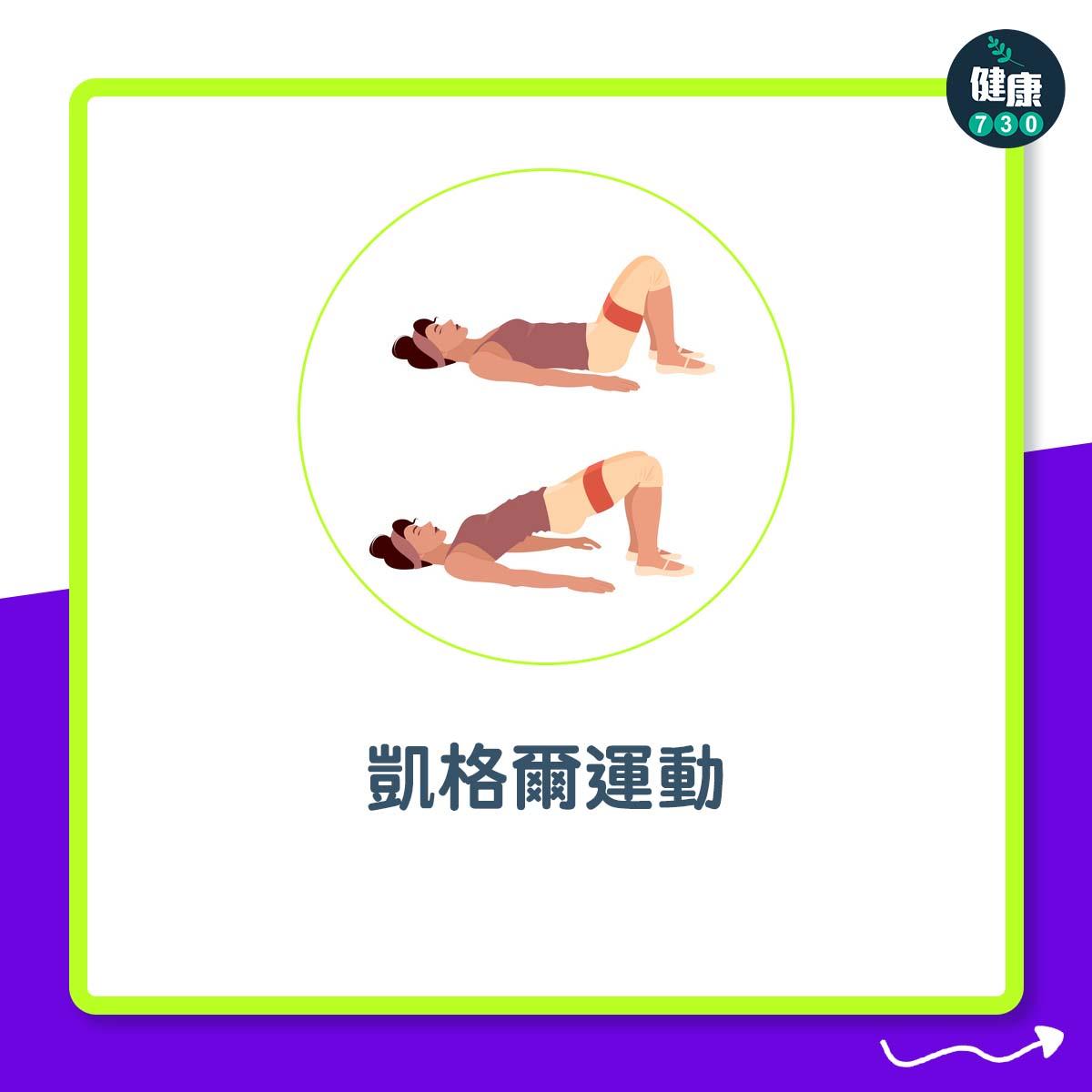 膀胱過度活躍症治療|凱格爾運動